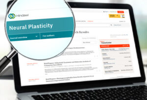 Artículos Científicos 5 neural plast 300x205 1